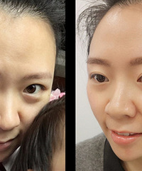 ǷüëôȵģӦʱõü¼