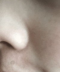 ��ʿ�ֲ����ܵ���Ĥ������������ë�����ͷ����ֱ������