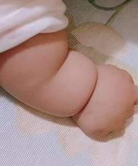 宝宝皮肤干燥怎么护理?