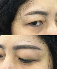 ȥСԺüʧܣϴ6Σڸüɹ