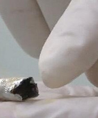 惊!6岁女童下体被塞铅笔头