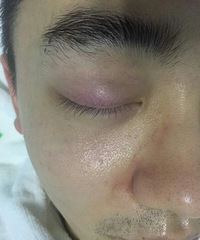 ����ҲҪ��Ƥ������������һ�Σ��۾��µ�ϸ�ƾ͵��˺ܶ�