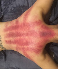 ��ˬ�����˸���ҩ����ȥʪ�������Ǹ����������Źǡ�