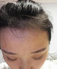 ͷٵĴͷֲ3ºڳŨܵķ