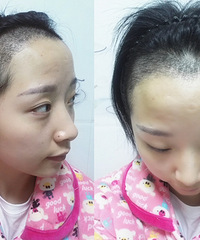 ͷٵĴͷֲ3ºڳŨܵķ