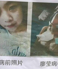 重庆一美女感冒输液,致皮肤烧伤