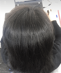 从几乎秃头到长满了头发,靠的就是这瓶生发神器