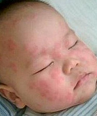 ޶¾Ϳʼʪҩ2£ʪڷ