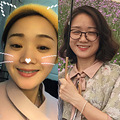 记录我的“整牙记”