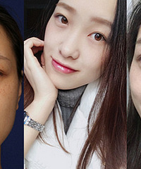 ܻĳƤߣû뵽һεЧô