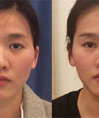 ߵüȻܹͽֵƽԳԣ治