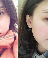 要和闺蜜一起美~薇漫里来助力,纹眉1590元,闺蜜同行还能9折
