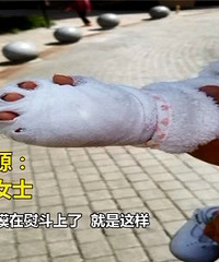 保姆熨衣服中途上厕所 一岁幼童手被烫伤