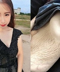 生完娃儿后的肚子,自己都无法直视