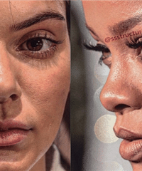 ѷһЩŷǵĸգƤͨ˻