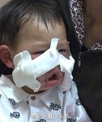 4ͯˤ򿪶еĵ⣬ҽԭ