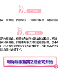 小仙女进化日记 说说内双为何要做双眼皮