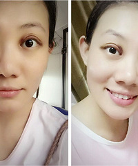 һ˫Ƥʧˣòȼʱ޸ֱ