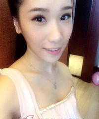 脂肪填充胸部效果图 %¥ 脂肪填充胸部恢复时间