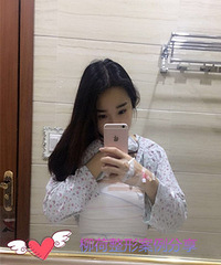 脂肪填充胸部效果图 %¥ 脂肪填充胸部恢复时间