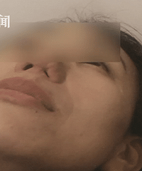 ����ֱ�ӣ�����ԺԱ��ȥ¡�ǣ���Ȼ�ѱǿ���û��