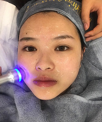 Ƥڼ䣬ˮƤ֬Ĥ޸飬ûô