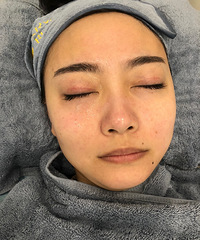 ÿ�λ���Ƥ�������׸���ȱˮ����������ˮ�����ף�Ƥ��ˮˮ��