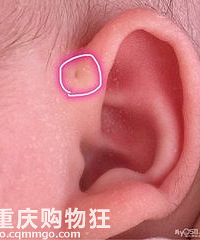 ϵġסҪע⣬Ҫǵüʱҽ