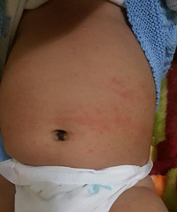 ±Ϻ͸ˣɫСҪȥҽԺ