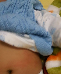 ±Ϻ͸ˣɫСҪȥҽԺ