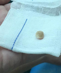 ףһŲΣ֪ͨ飡ҽ4000Ҹתุĸ