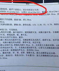 求推荐管饱又低脂的孕期零食!【孕期龙门阵】