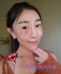 ֬����������ָ�ʱ�� %�� ֬����������Ա���Ƭ