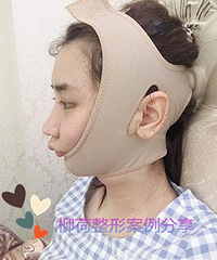 面部吸脂手术价格 *¥ 吸脂手术最好的医院