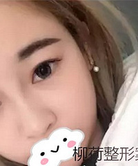 假体隆鼻手术价格 %@ 假体隆鼻恢复时间