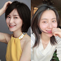 矫正牙齿后我变得爱笑