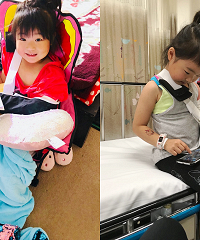 生活在澳洲的我们,聊聊娃儿摔断手之后
