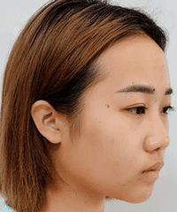 �������������ġ����ӡ��������²���¡�ǣ���͸�⻹�������