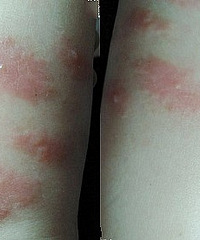 ޶պ󣬽ϳЩоˮʲô?