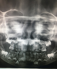 𣬴Сûйע޶⣬û뵽ڻô