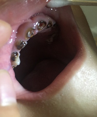 𣬴Сûйע޶⣬û뵽ڻô