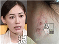 马蓉哭诉被王宝强家暴
