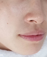 ����Ƥ��������ȥ��ͷ��Ч��̫�����������׿�˥������Ƥ����ˮ��