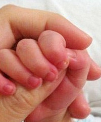 øпԭѡ񶡿˵ĽΪĸ׵˰֢֮Ҳ