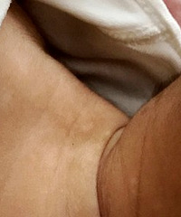 ǰװ޶֮ǰʪӣҩ֮׵