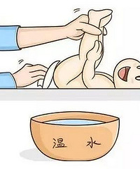 夏天到了,尿布疹做好预防,跟红屁股说拜拜