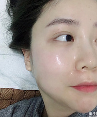 ˮƤ޸Ƥˮ󣬷պ˺ܶ