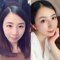 征集免费体验玻尿酸的小姐姐