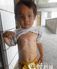 ������ԣ�����潭5���к����ױ�˭������֢�໤�ң�