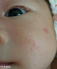 ϳ˶˭֪ʲôҪȥҽԺ